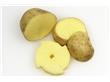 养生：土豆健脾和胃还能减肥 怎么吃有诀窍（2）