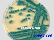 蜡样芽胞杆菌显色培养基